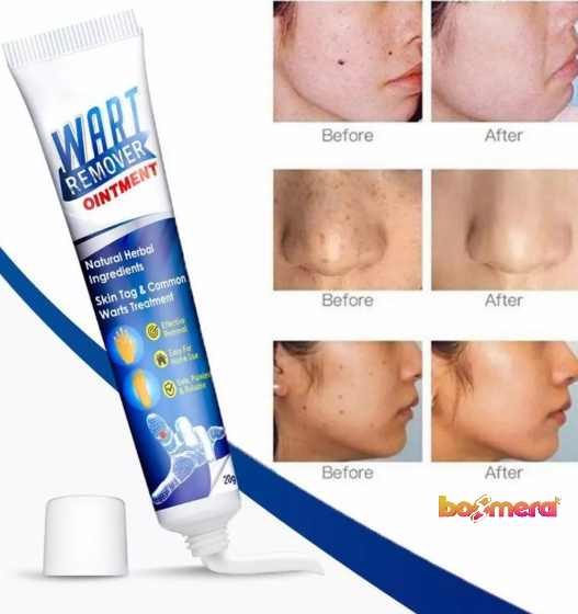 Crema para Eliminar las Verrugas Wart - Boomera